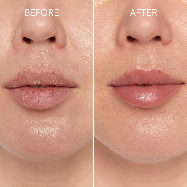 glov-perfect-lips-set-de-cuidado-de-labios-con-scrubex-exfoliante-y-lip-butter-d image 2